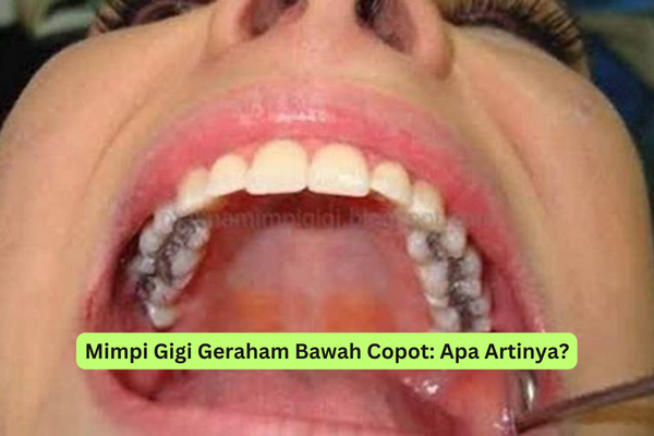 Mimpi Gigi Geraham Bawah Copot Apa Artinya