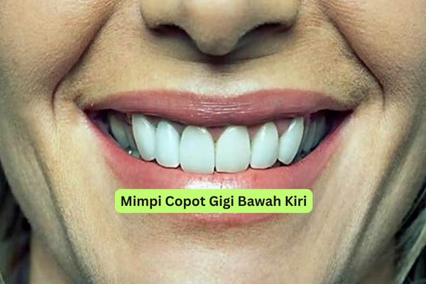 Mimpi Copot Gigi Bawah Kiri