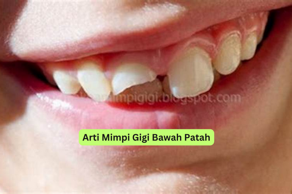 Arti Mimpi Gigi Bawah Patah